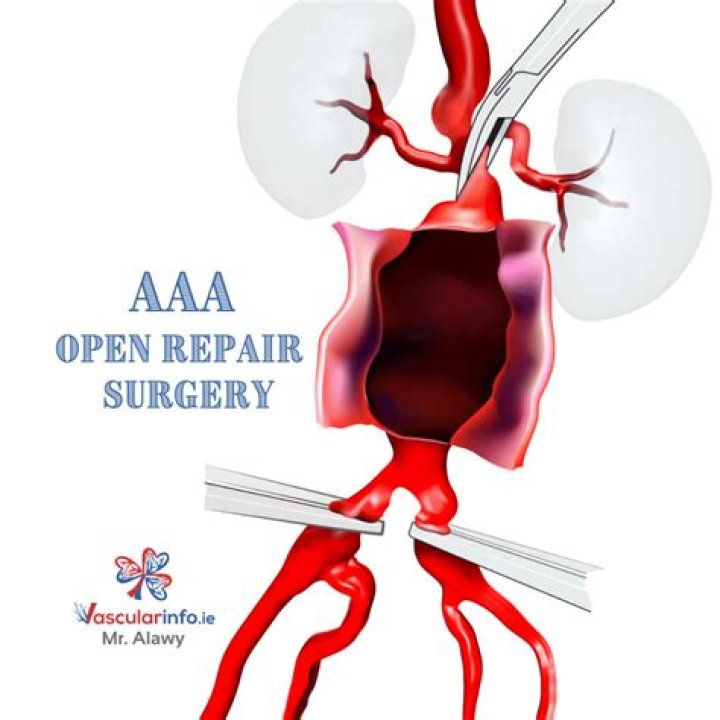 Aaa Open Saturday - How To Discuss
