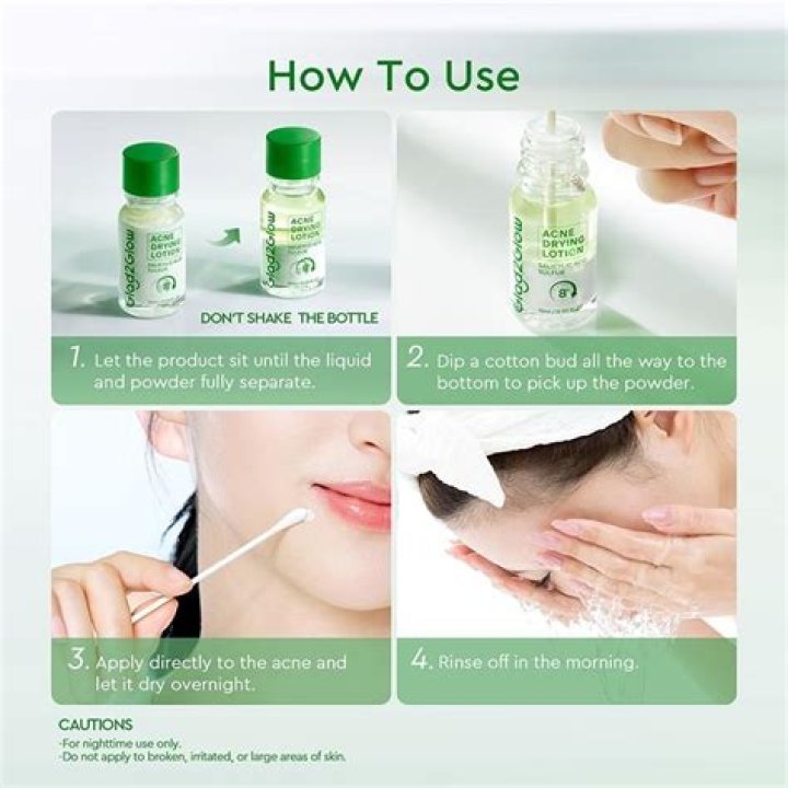 Acne drying lotion - How To Discuss