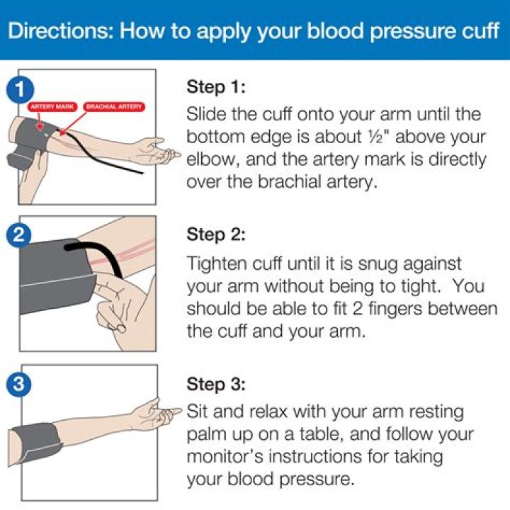 At what blood pressure do you lose radial pulse