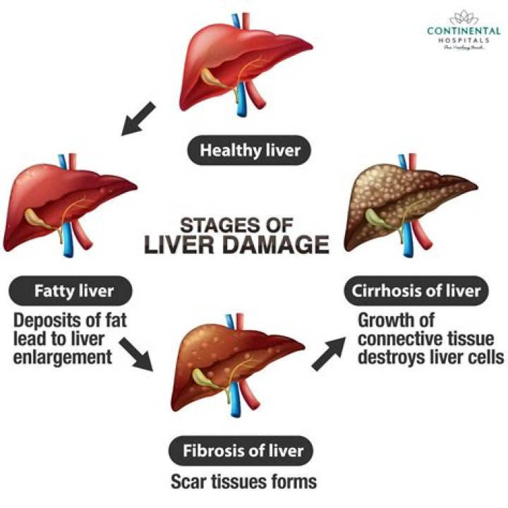 Can Forteo cause liver damage