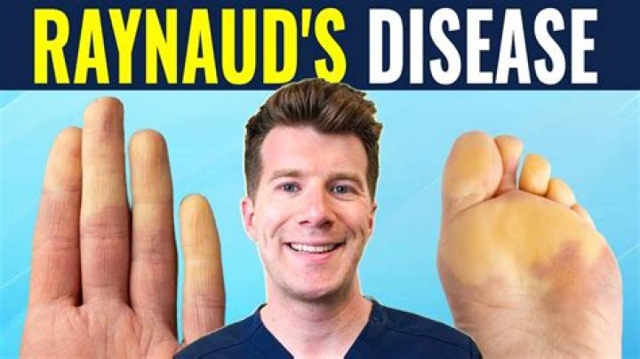 Can Raynaud cause permanent numbness