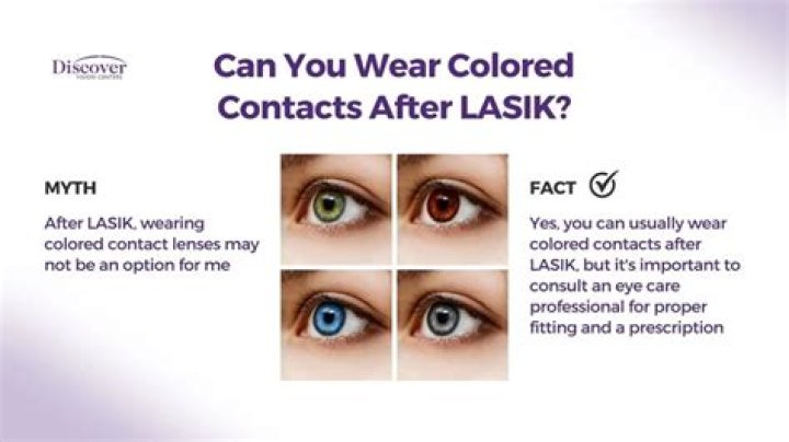 Can You Wear Colored Contacts After Lasik