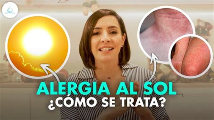 ¿Cómo se llama la alergia a la luz solar