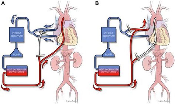 Did HM have anterograde or retrograde amnesia