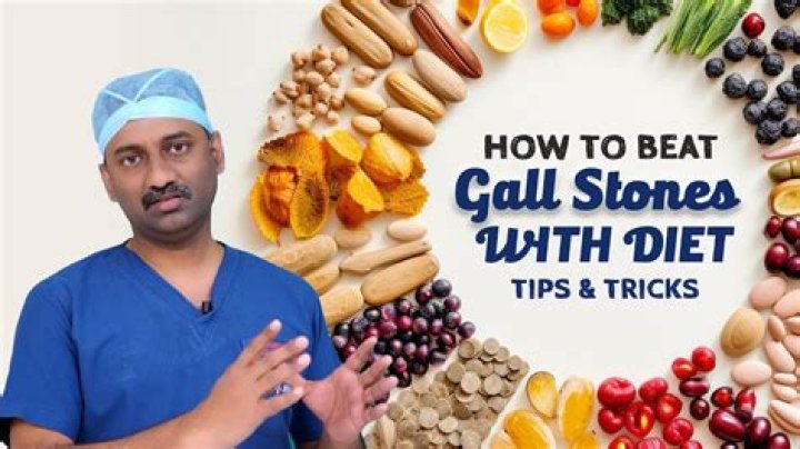 Does a low fat diet help gallstones