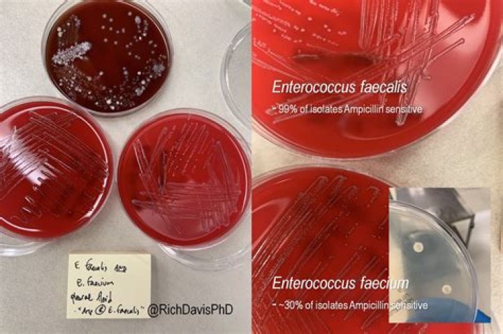 Does Enterococcus faecalis require isolation