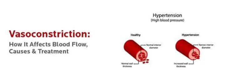 Does exercise cause vasoconstriction