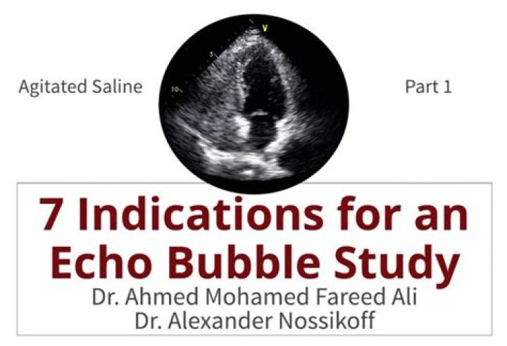Echo bubble - How To Discuss