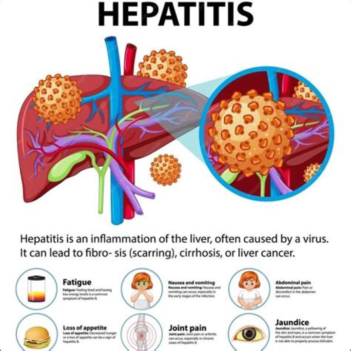 Hepatitis - How To Discuss