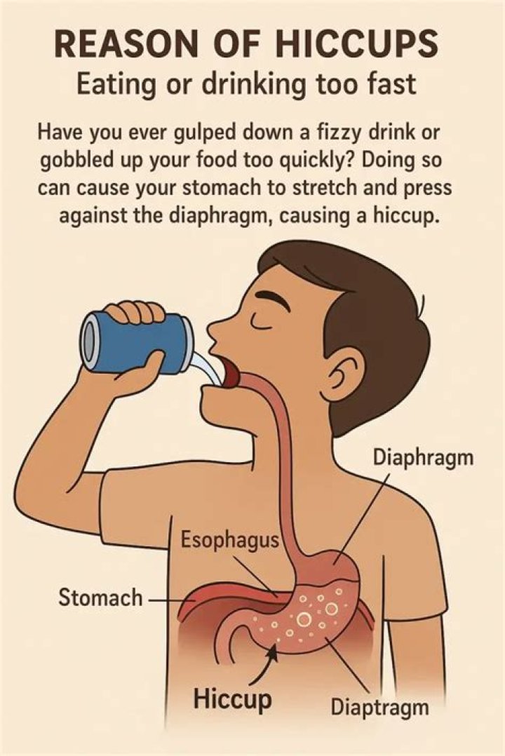 Hiccups after eating - How To Discuss