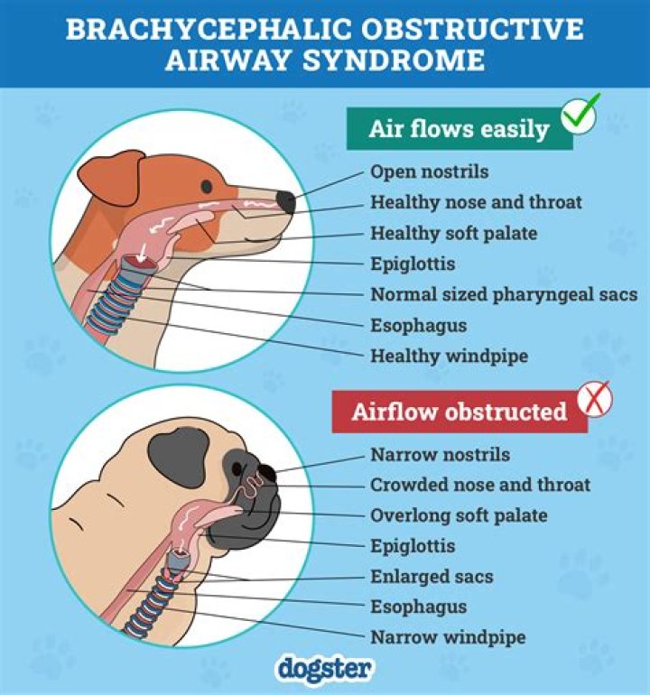How do you check airway breathing circulation