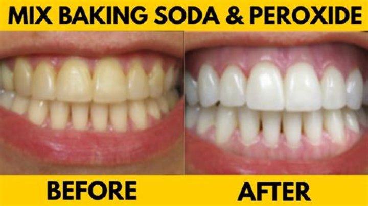 How Much Baking Soda Is Too Much