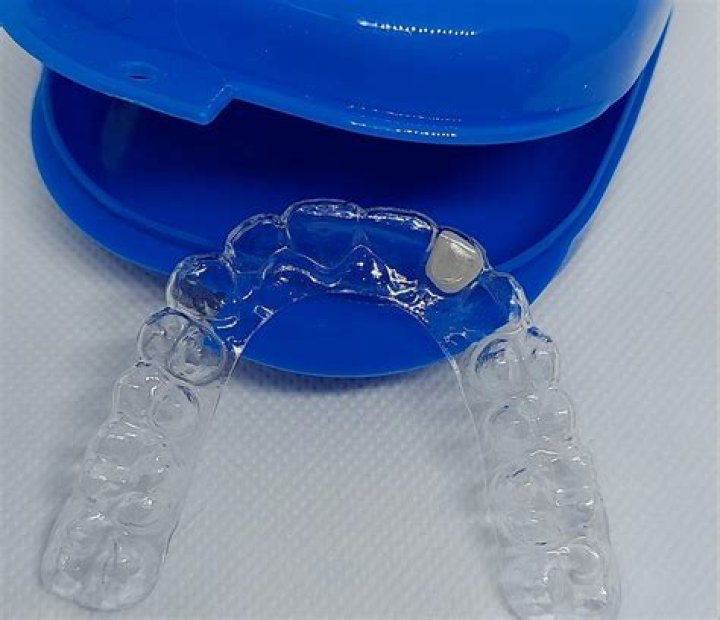How often should essix retainers be replaced