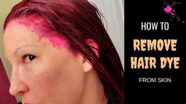 How to get hair dye off skin