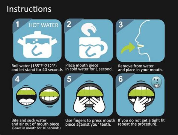 How to mold a mouthguard