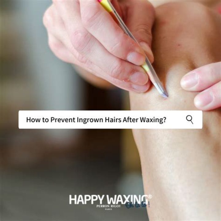 How to prevent ingrown hairs after waxing