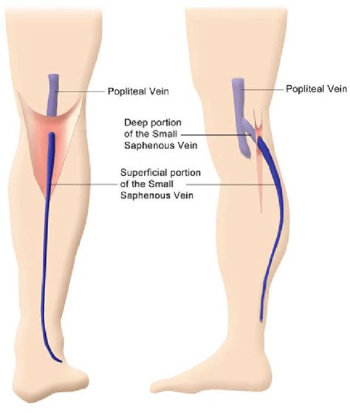 In what region of the body is the great saphenous vein