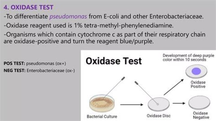 Is E coli oxidase positive or negative