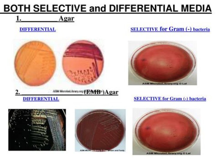 Is EMB media selective differential or both