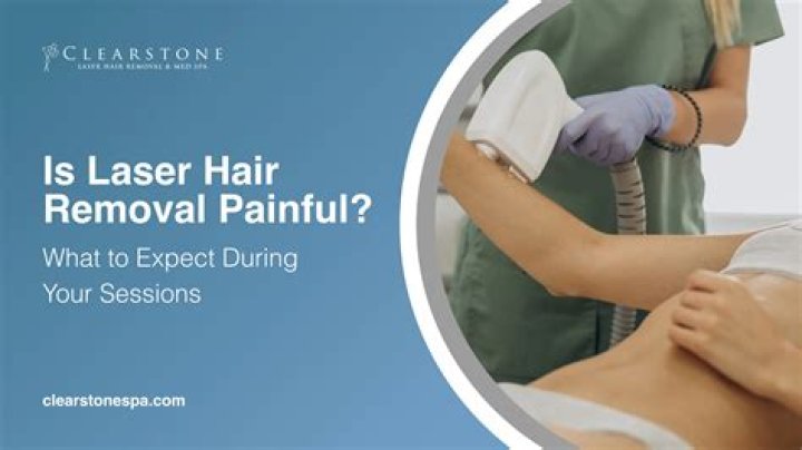 Is laser hair removal painful