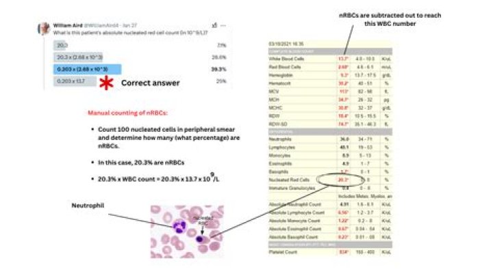 Nrbc blood test - How To Discuss