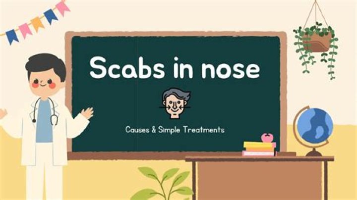 Scabs in nose - How To Discuss
