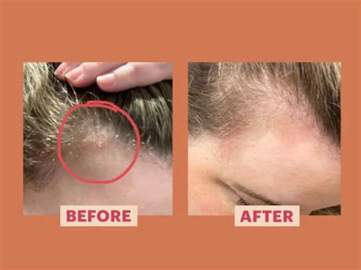 Stop hair loss - How To Discuss