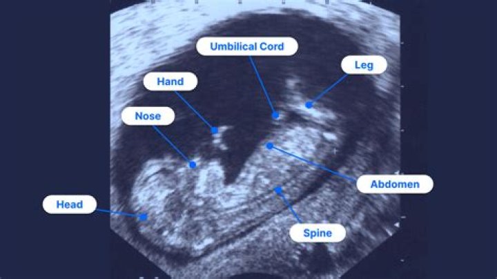 Ultrasound - How To Discuss