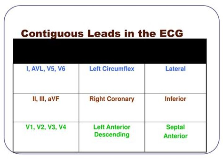 What are contiguous leads in ECG
