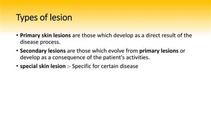 What are primary and secondary lesions