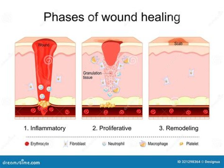 What are the 3 stages of healing and tissue repair