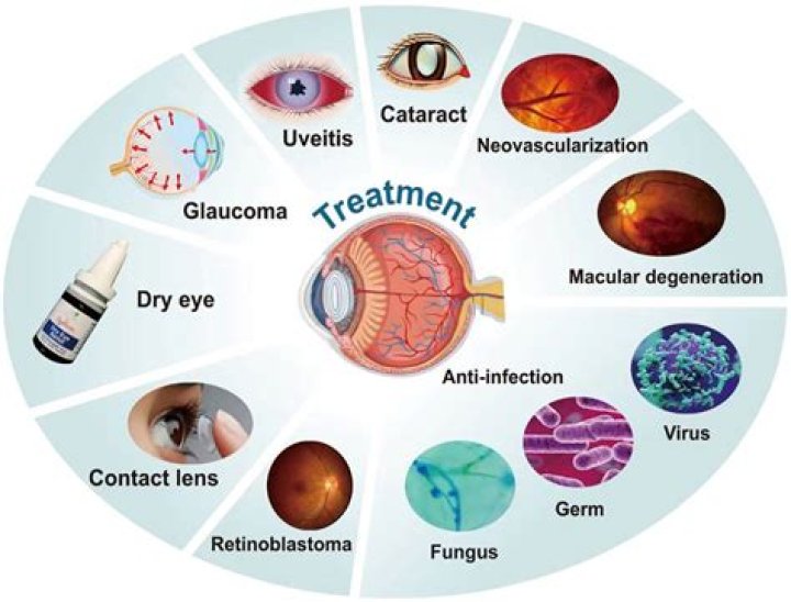 What are the different eye diseases