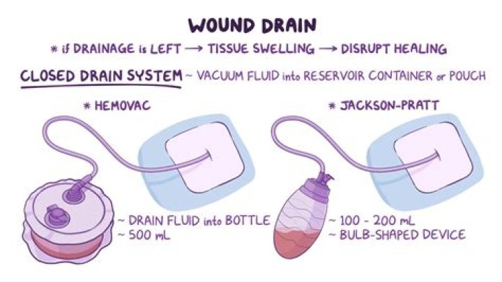What are the drains for after surgery