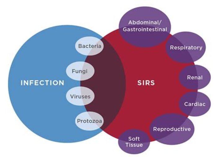 What can cause sirs