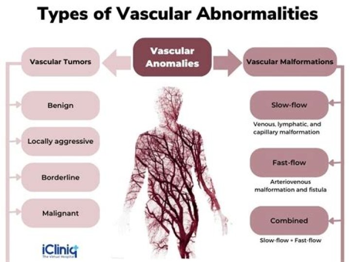 What causes a vascular tumor