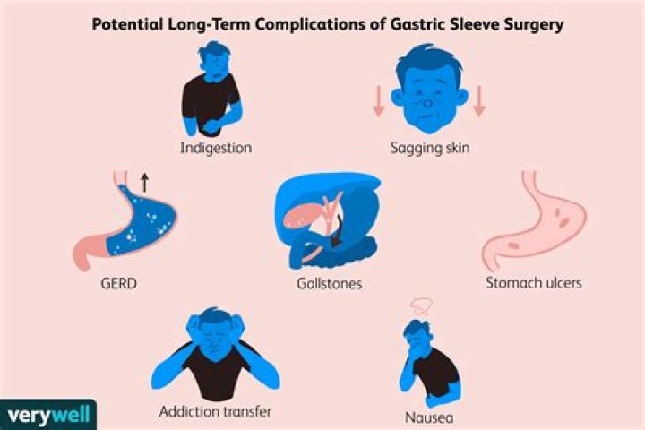 What causes headaches after gastric sleeve surgery