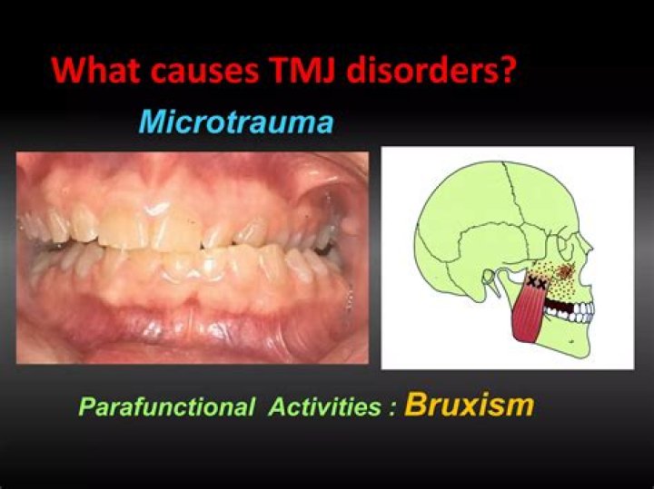 What causes microtrauma