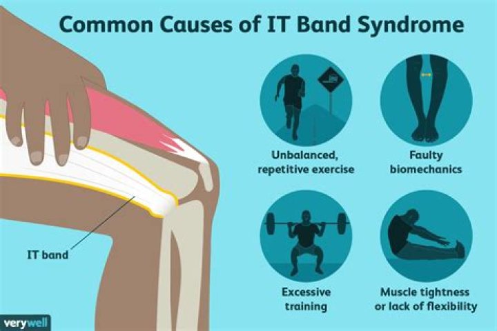 What causes tight IT band