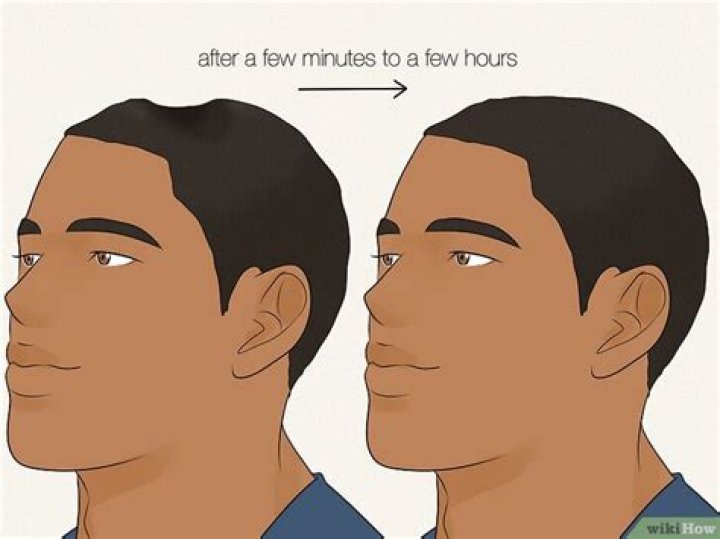 What does a dent in a tire mean