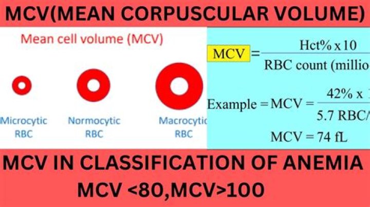 What does MCV of 100 mean