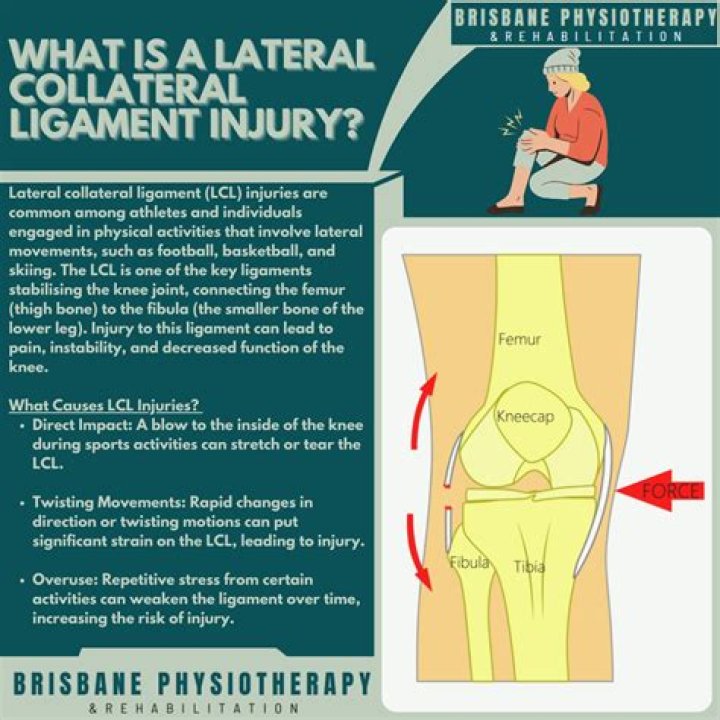 What does tibial collateral ligament prevent