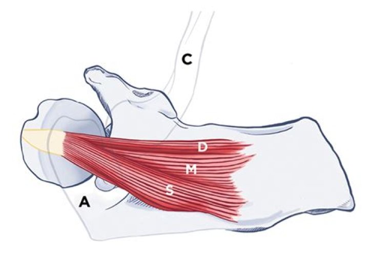 What is a Myotendinous injury