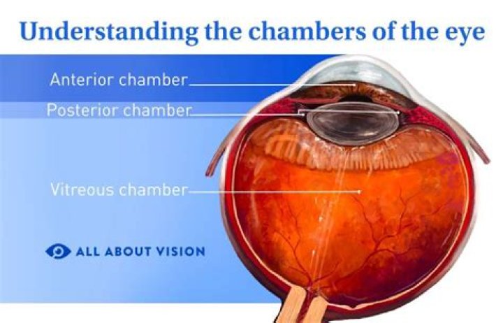 What is anterior chamber reaction