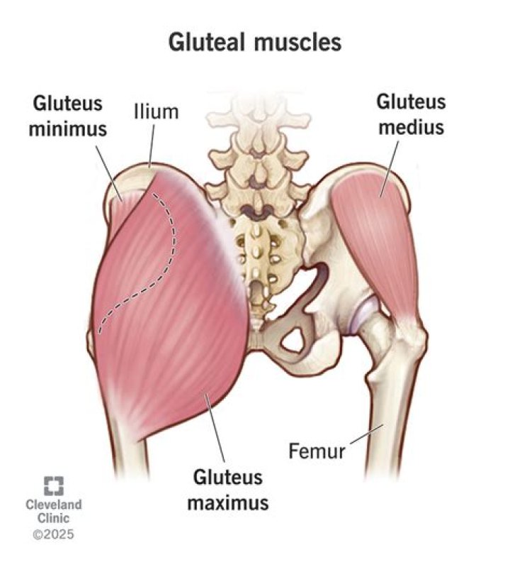 What is gluteus medius gait