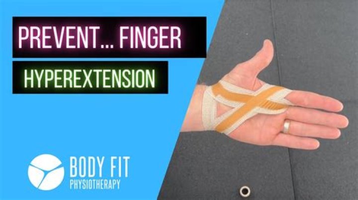 What is hyperextension of the finger