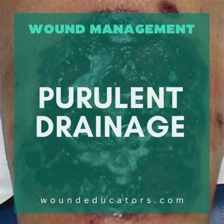 What is in purulent drainage