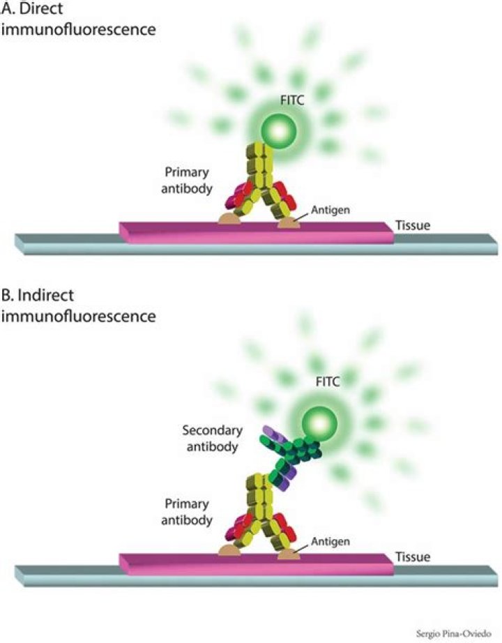 What is indirect immunofluorescence assay