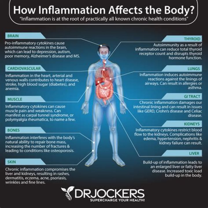 What is inflammation of the kidney