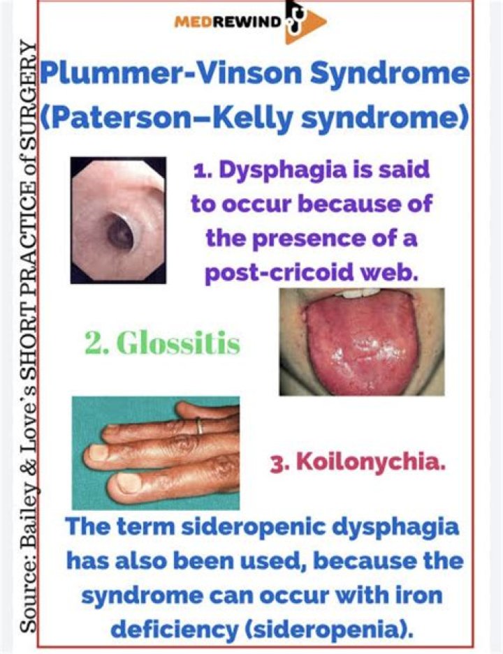 What is Paterson Kelly Syndrome