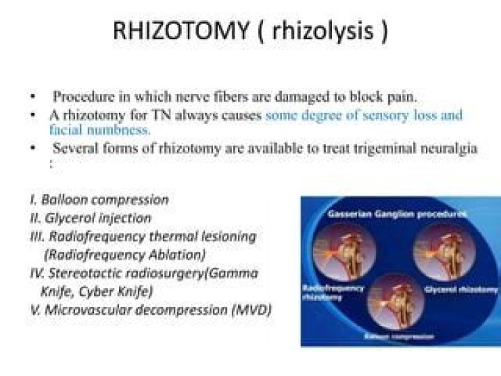What is Rhizolysis procedure